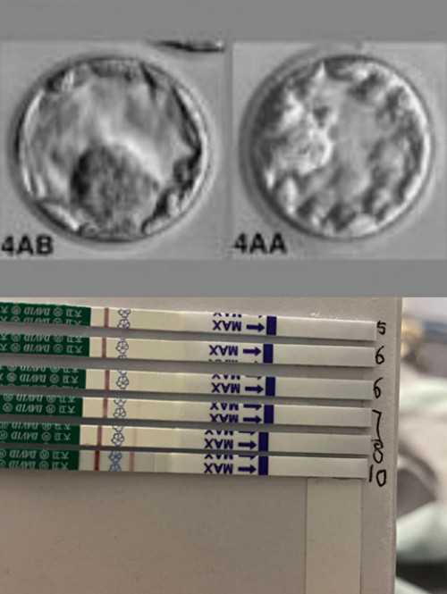 添宝助孕网+东峻国际上门洽谈,试管婴儿移植什么样的内膜最好？哪种形态最好