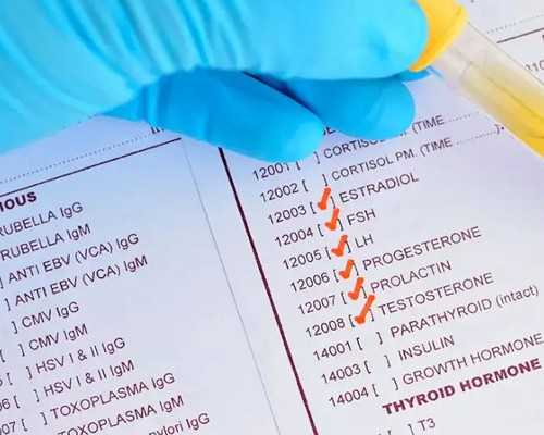 上环月经不走能取环吗（月经推迟几天算正常）