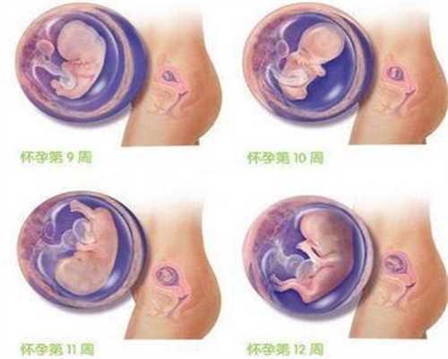 卵巢早衰生孩子供卵流程_34岁江美琪将停工安胎