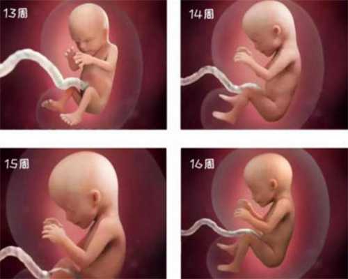 代孕费用_妈妈应该谨防的新生儿6种先天性眼疾